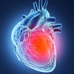 Cardiac Operations — Transcatheter aortic valve implantation (TAVI)