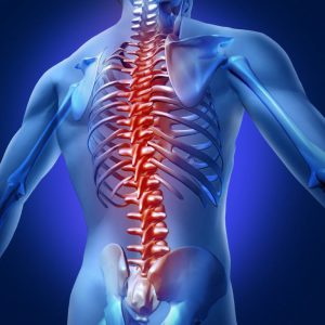 Orthopedics — Scoliosis correction