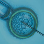 Cost of IVF in Jordan: MedXJordan Guide for Local and International Patients