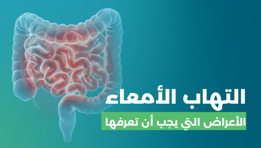 التهاب الامعاء: الأعراض، الأسباب، التشخيص وطرق العلاج